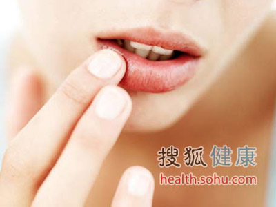 嘴唇就是健康的晴雨表