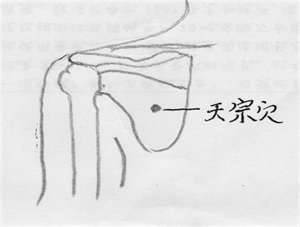 如何提高针灸丰胸效果