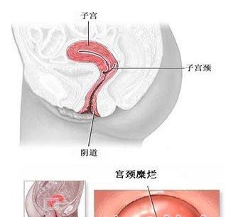 女性私处暗藏12个健康秘密 分泌物多怎么回事？