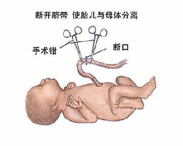 晚剪脐带2分钟白血病风险低50%？ 专家：不科学