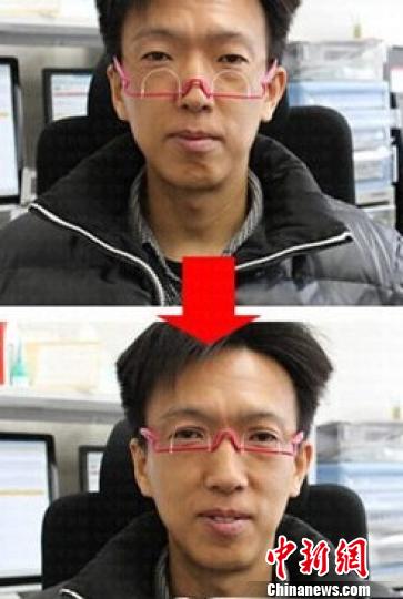 “双眼皮眼镜”受热捧 医生称配戴不慎伤眼皮